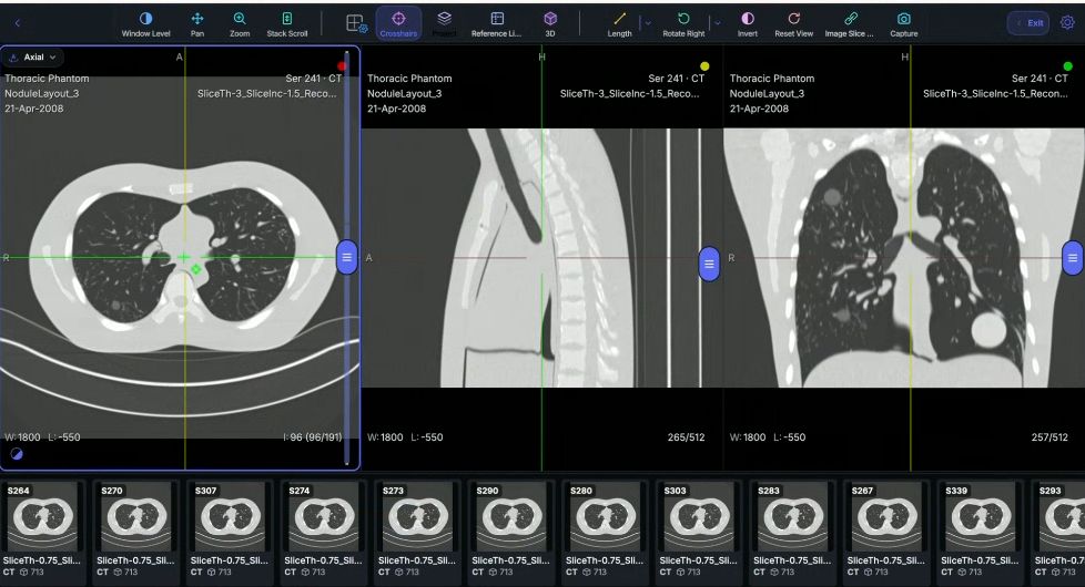 Clinical DICOM Viewer — Multi-planar CT diagnostic interface