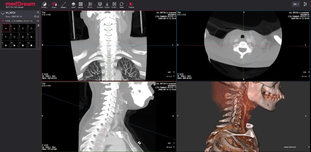 MedDream DICOM Viewer